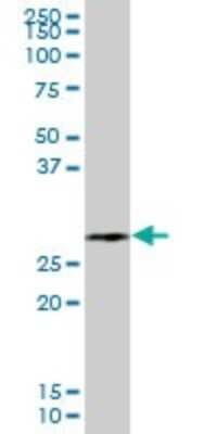 Western Blot: C1QB Antibody [H00000713-B01P] - Analysis of C1QB expression in human pancreas.