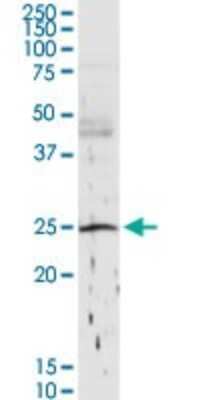Western Blot: C1QB Antibody [H00000713-D01P] - Analysis of C1QB expression in human pancreas.