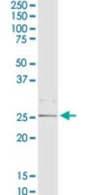 Western Blot: C1QB Antibody [H00000713-D01P] - Analysis of C1QB expression in mouse stomach.