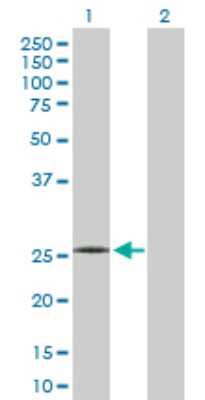 Western Blot: C1QB Antibody [H00000713-D01P] - Analysis of C1QB expression in transfected 293T cell line by C1QB polyclonal antibody.Lane 1: C1QB transfected lysate(26.70 KDa).Lane 2: Non-transfected lysate.