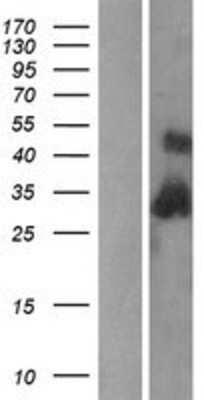 Western Blot C1QB Overexpression Lysate