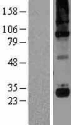 Western Blot Complement Component C1qC Overexpression Lysate