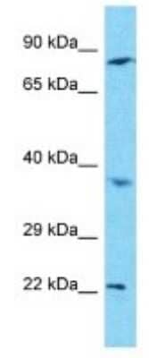 Western Blot C1orf105 Antibody - BSA Free