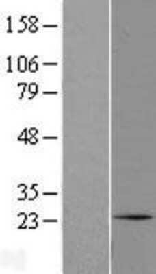 Western Blot: C1orf105 Overexpression Lysate (Adult Normal) [NBL1-08290] Left-Empty vector transfected control cell lysate (HEK293 cell lysate); Right -Over-expression Lysate for C1orf105.