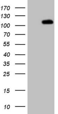 Western Blot: C1orf106 Antibody (6A6) [NBP2-46597] - Analysis of HEK293T cells were transfected with the pCMV6-ENTRY control (Left lane) or pCMV6-ENTRY C1orf106.