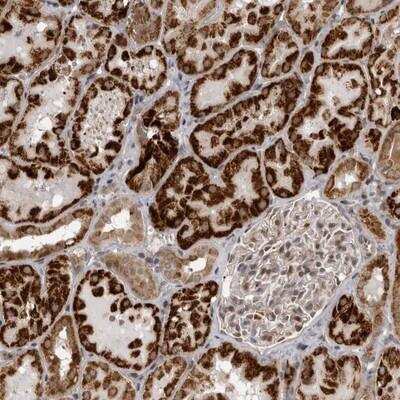 Immunohistochemistry: C1orf109 Antibody [NBP1-82176] - Staining of human kidney shows strong cytoplasmic positivity in cells of renal tubules.