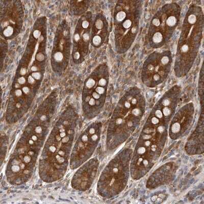 Immunohistochemistry-Paraffin: C1orf109 Antibody [NBP1-82175] - Staining of human duodenum shows strong cytoplasmic positivity in glandular cells.