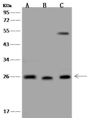 Western Blot: C1orf109 Antibody [NBP3-05934] - Lane A: K562 Whole Cell LysateLane B: RPMI-8226 Whole Cell LysateLane C: U251MG Whole Cell LysateLysates/proteins at 30 ug per lane.SecondaryGoat Anti-Rabbit IgG (H+L)/HRP at 1/10000 dilution.Developed using the ECL technique.Performed under reducing conditions.Predicted band size:23 kDaObserved band size:26 kDa(We are unsure as to the identity of these extra bands.)