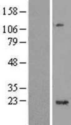 Western Blot: C1orf109 Overexpression Lysate (Adult Normal) [NBL1-08292] Left-Empty vector transfected control cell lysate (HEK293 cell lysate); Right -Over-expression Lysate for C1orf109.