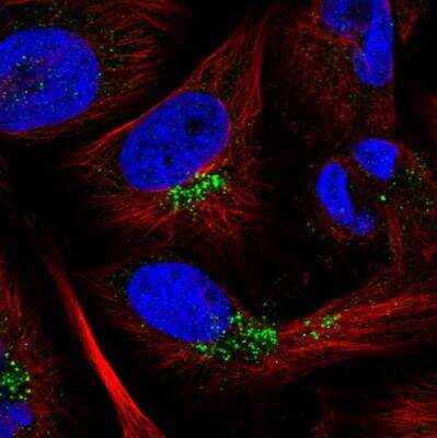 Immunocytochemistry/Immunofluorescence: C1orf110 Antibody [NBP1-82672] - Staining of human cell line U-251 MG shows localization to vesicles. Antibody staining is shown in green.
