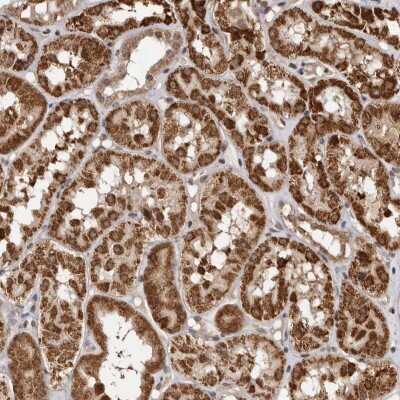 Immunohistochemistry-Paraffin: C1orf110 Antibody [NBP1-82672] - Staining of human kidney shows strong granular cytoplasmic positivity in tubular cells.