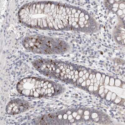 Immunohistochemistry-Paraffin: C1orf110 Antibody [NBP1-82673] - Staining of human colon shows nuclear positivity in a fraction of basal glandular cells.