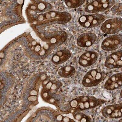 Immunohistochemistry-Paraffin: C1orf110 Antibody [NBP1-82674] - Staining of human duodenum shows strong cytoplasmic positivity in glandular cells.