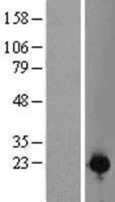 Western Blot: C1orf123 Overexpression Lysate (Adult Normal) [NBL1-08294] Left-Empty vector transfected control cell lysate (HEK293 cell lysate); Right -Over-expression Lysate for C1orf123.
