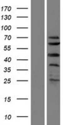 Western Blot SPRTN Overexpression Lysate