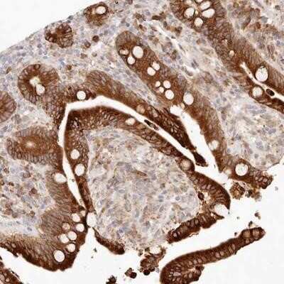 Immunohistochemistry-Paraffin: C1orf127 Antibody [NBP1-93807] - Staining of human colon shows strong cytoplasmic positivity in glandular cells.