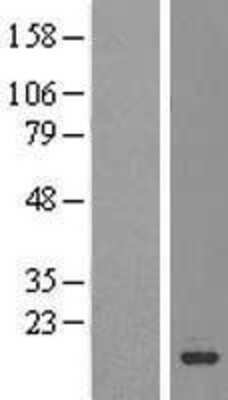 Western Blot: C1orf144 Overexpression Lysate (Adult Normal) [NBL1-08298] Left-Empty vector transfected control cell lysate (HEK293 cell lysate); Right -Over-expression Lysate for C1orf144.