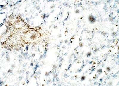 Immunohistochemistry-Paraffin: C1orf146 Antibody [NBP3-12292] - Rat kidney. 1:100 dilution in IHC blocking buffer. DAB (brown) staining and Hematoxylin QS (blue) counterstain. 40X magnification.