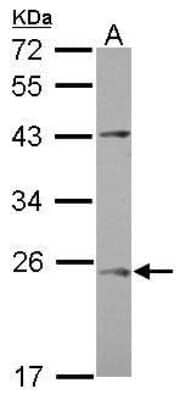 Western Blot: C1orf146 Antibody [NBP2-42820] - Analysis of 30 ug whole cell lysate. A: Raji 12% SDS PAGE diluted at 1:1000.