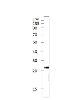 Western Blot: C1orf146 Antibody [NBP3-12292] - Rat kidney. 1:500 antibody dilution in DiluObuffer. Apparent MW is 22 KDa.