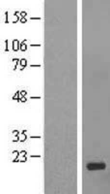 Western Blot GCSAML Overexpression Lysate