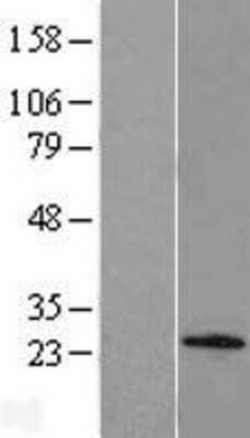 Western Blot: C1orf158 Overexpression Lysate (Adult Normal) [NBL1-08301] Left-Empty vector transfected control cell lysate (HEK293 cell lysate); Right -Over-expression Lysate for C1orf158.