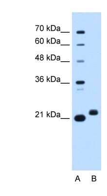 Western Blot: C1orf159/RIVIG Antibody [NBP1-91307] - HepG2 cell lysate, concentration 0.2-1 ug/ml.