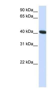 Western Blot: C1orf159/RIVIG Antibody [NBP1-91308] - HepG2 cell lysate, concentration 0.2-1 ug/ml.