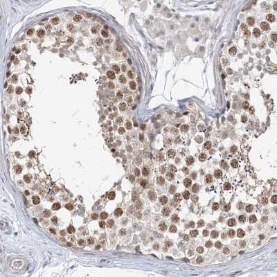 Immunohistochemistry: C1orf177 Antibody [NBP2-32711] - Staining of human testis shows moderate nuclear positivity in cells in seminiferus ducts.