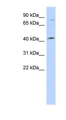 Western Blot: C1orf177 Antibody [NBP1-70454] - 721_B cell lysate, concentration 0.2-1 ug/ml.
