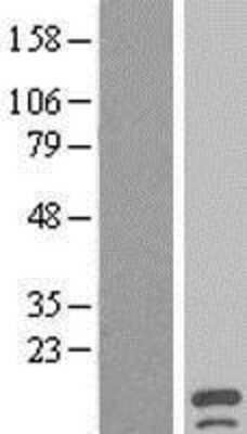 Western Blot: C1orf182 Overexpression Lysate (Adult Normal) [NBL1-08305] Left-Empty vector transfected control cell lysate (HEK293 cell lysate); Right -Over-expression Lysate for C1orf182.