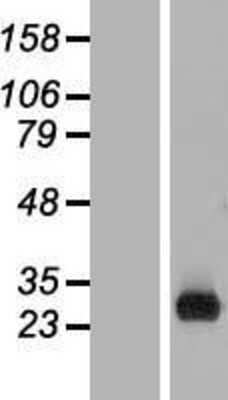 Western Blot C1orf186 Overexpression Lysate