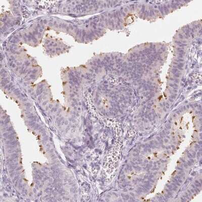 Immunohistochemistry-Paraffin: C1orf194 Antibody [NBP2-38605] - Staining of human fallopian tube shows high expression.