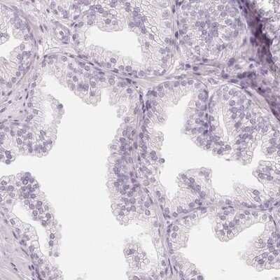 Immunohistochemistry-Paraffin: C1orf194 Antibody [NBP2-38605] - Staining of human prostate shows low expression as expected.
