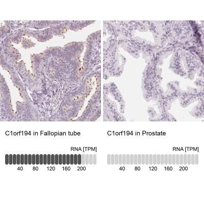 Immunohistochemistry-Paraffin: C1orf194 Antibody [NBP2-38605] - Staining in human fallopian tube and prostate tissues using anti-C1orf194 antibody. Corresponding C1orf194 RNA-seq data are presented for the same tissues.