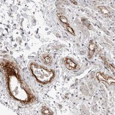 Immunohistochemistry-Paraffin C1orf216 Antibody - BSA Free