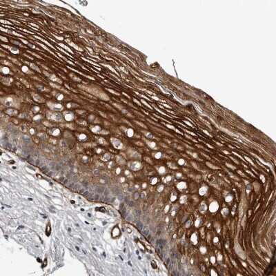 Immunohistochemistry-Paraffin C1orf216 Antibody - BSA Free