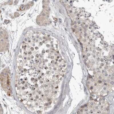Immunohistochemistry-Paraffin C1orf216 Antibody - BSA Free