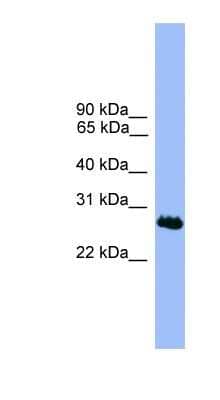Western Blot C1orf216 Antibody - BSA Free