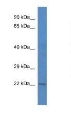Western Blot: C1orf216 Antibody [NBP1-74251] - Titration: 1.0 ug/ml Positive Control: Mouse Pacreas.
