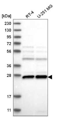 Western Blot: C1orf216 Antibody [NBP2-58717] - Analysis in human cell line RT-4 and human cell line U-251 MG.
