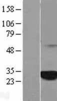 Western Blot C1orf216 Overexpression Lysate