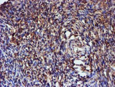 Immunohistochemistry-Paraffin: C1orf50 Antibody (1C6) [NBP2-00778] - Staining of paraffin-embedded Human Ovary tissue using anti-C1orf50 mouse monoclonal antibody.