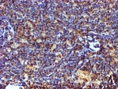 Immunohistochemistry: C1orf50 Antibody (OTI1C6) - Azide and BSA Free [NBP2-72188] - C1orf50 Antibody (1C6) [NBP2-00778