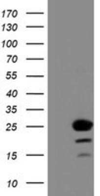 Western Blot: C1orf50 Antibody (OTI1C6) - Azide and BSA Free [NBP2-72188] - HEK293T cells were transfected with the pCMV6-ENTRY control (Left lane) or pCMV6-ENTRY C1orf50 (Right lane) cDNA for 48 hrs and lysed. Equivalent amounts of cell lysates (5 ug per lane) were separated by SDS-PAGE and immunoblotted with anti-C1orf50.