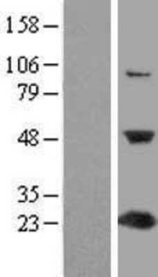 Western Blot: C1orf50 Overexpression Lysate (Adult Normal) [NBL1-08320] Left-Empty vector transfected control cell lysate (HEK293 cell lysate); Right -Over-expression Lysate for C1orf50.