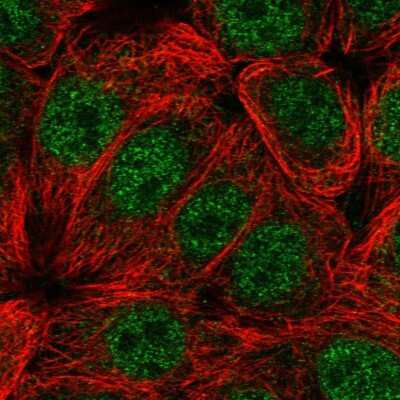 Immunocytochemistry/Immunofluorescence: C1orf51 Antibody [NBP2-55476] - Staining of human cell line MCF7 shows localization to nucleoplasm.