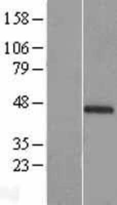 Western Blot: C1orf51 Overexpression Lysate (Adult Normal) [NBL1-08321] Left-Empty vector transfected control cell lysate (HEK293 cell lysate); Right -Over-expression Lysate for C1orf51.