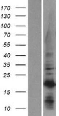 Western Blot C1orf52 Overexpression Lysate