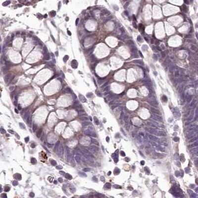 Immunohistochemistry-Paraffin: MENT Antibody [NBP1-82174] - C1orf56 Antibody [NBP1-82174] - Staining of human colon.